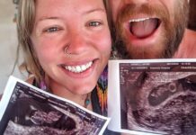 Серйозність питання: коли втрата вагітності відлунює в ненав’язливих зауваженнях