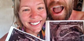 The Weight of a Question: When Pregnancy Loss Echoes in Casual Remarks